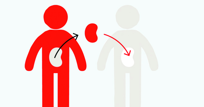 Uncertainty Looms As COVID-19 Halts Organ Transplant